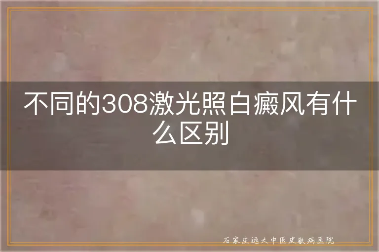 不同的308激光照白癜风有什么区别