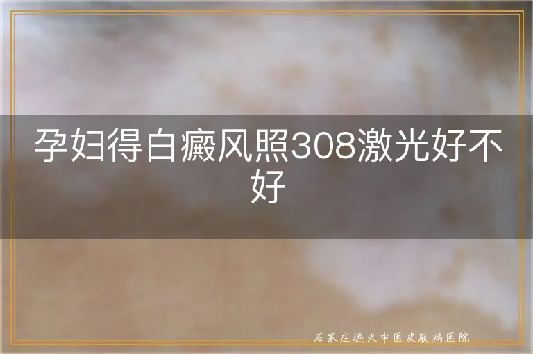 孕妇得白癜风照308激光好不好