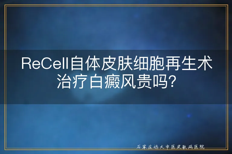 ReCell自体皮肤细胞再生术治疗白癜风贵吗？