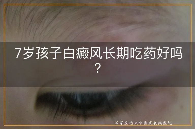 7岁孩子白癜风长期吃药好吗？