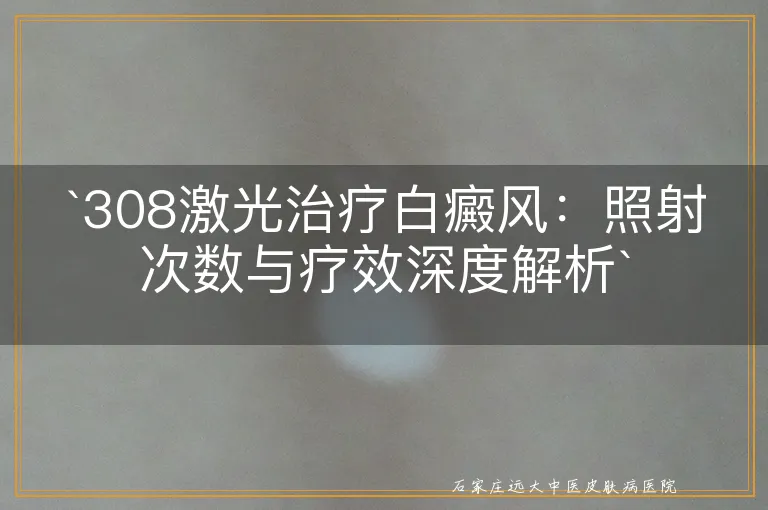 `308激光治疗白癜风：照射次数与疗效深度解析`