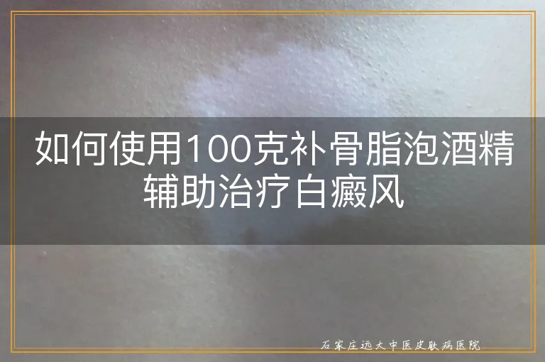 如何使用100克补骨脂泡酒精辅助治疗白癜风