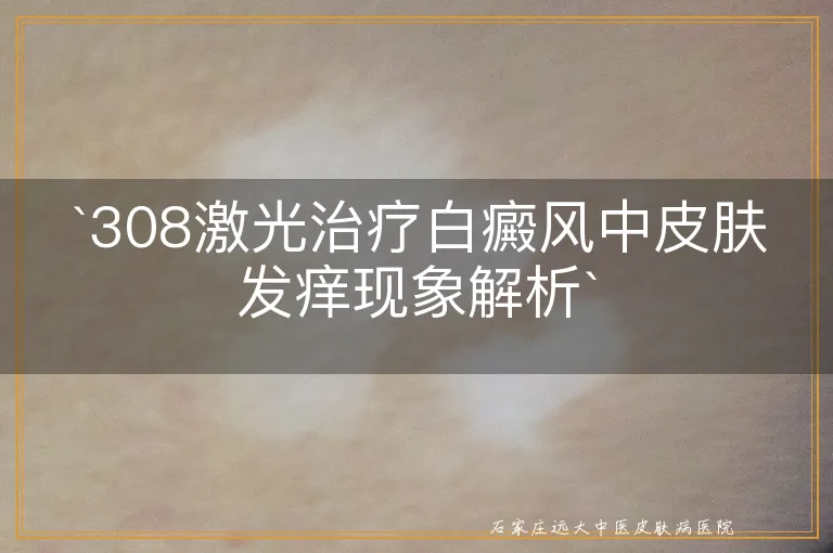 `308激光治疗白癜风中皮肤发痒现象解析`