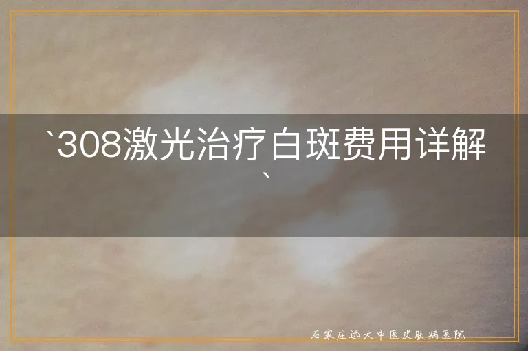 `308激光治疗白斑费用详解`