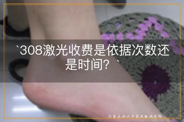 `308激光收费是依据次数还是时间？`