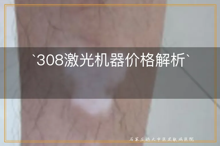 `308激光机器价格解析`