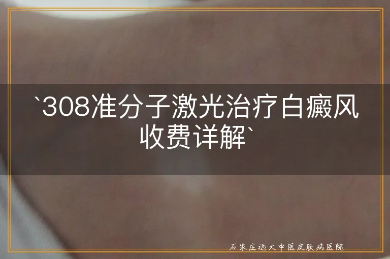 `308准分子激光治疗白癜风收费详解`