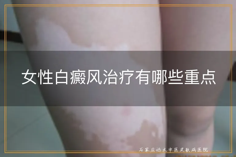 女性白癜风治疗有哪些重点