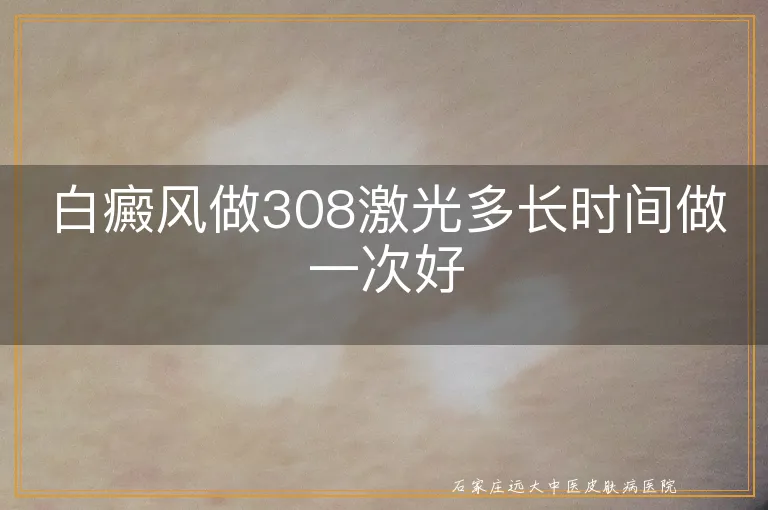 白癜风做308激光多长时间做一次好