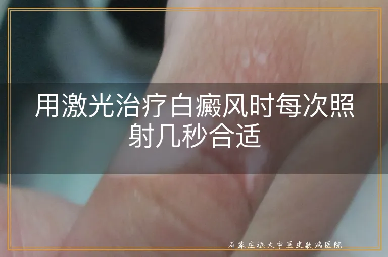 用激光治疗白癜风时每次照射几秒合适