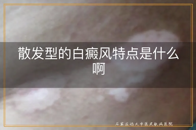 散发型的白癜风特点是什么啊