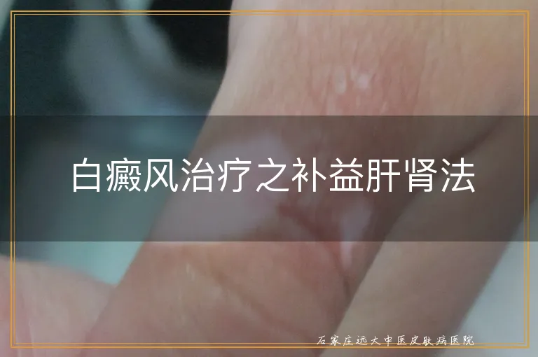 白癜风治疗之补益肝肾法