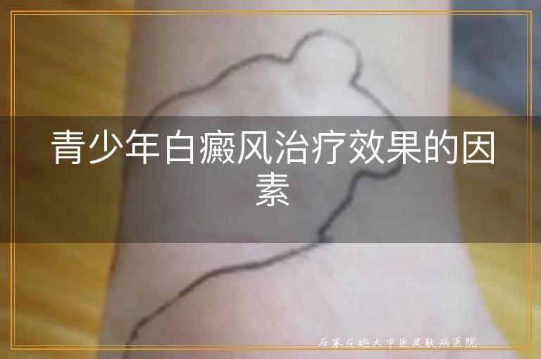 青少年白癜风治疗效果的因素