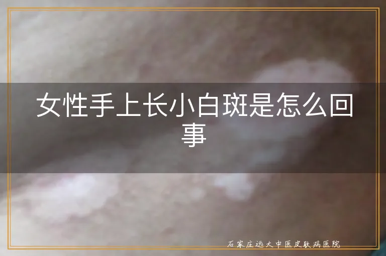 女性手上长小白斑是怎么回事